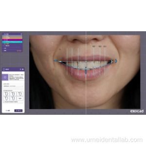 Customized Dsd And Cad Design