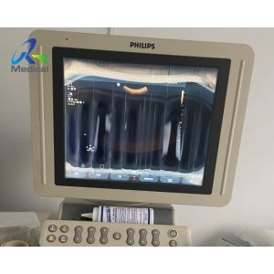 HD11 Image Blurred Image Anomaly Ultrasound Machine Repair Monitor