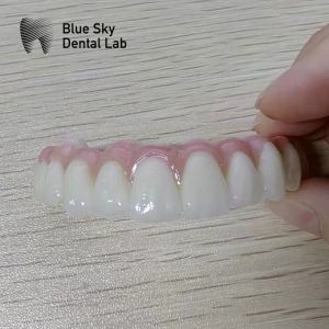 Nature Implant Procedure Cases with Universal Compatibility and Optimal