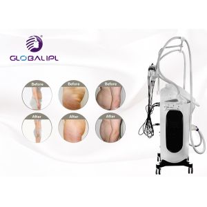 Multifunctional RF Cavitation Cryolipolysis Machine 5 Treatment Models