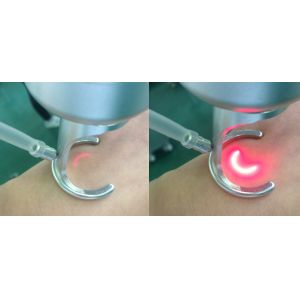 Stationary Fractional Laser Co2 Machine Scar Removal Infrared Skin