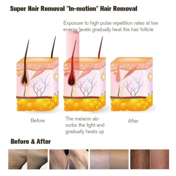 Professional Permanent IPL OPT Epilator Skin Rejuvenation Hair Removal Machine