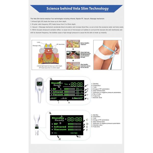 4 Handle Lipo Contour Vela shape Machine Cavitation Cellulite Removal Vacuum Rf Roller Massage