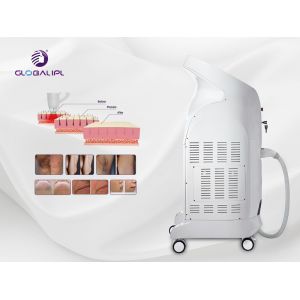 808nm Wavelength Diode Laser Hair Removal Machine 10Hz Frequency US408