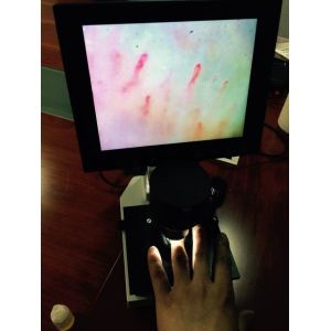 Magnification 400 Times Digital Microcirculation Microscope Nailfold Microcircul