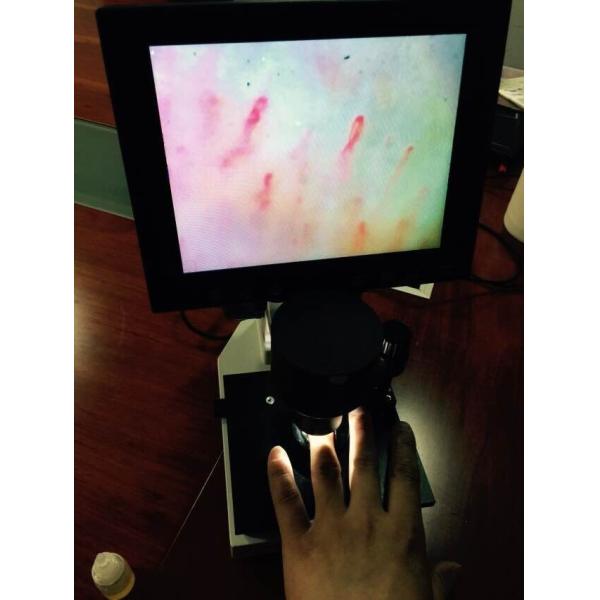 Magnification 400 Times Digital Microcirculation Microscope Nailfold Microcircul