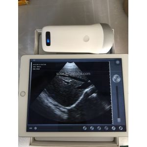 Wireless ultrasound probe iphone ultrasound probe uprobe-2(Convex) with ISO and