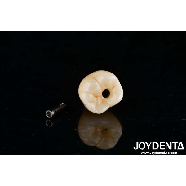 Buy Internal Hex Titanium Dental Implants Precision Machining With Zero Angulation at wholesale prices