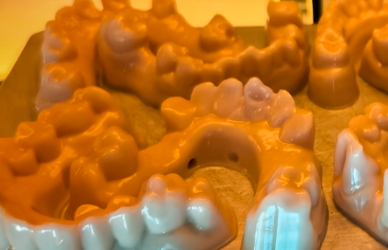 Model Resin Dental Realistic Teaching Demonstration Production Efficiency Clinical Accuracy