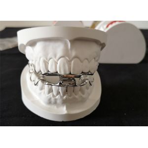 OEM Dental Orthodontic Appliances High Strength 3D Digital Design