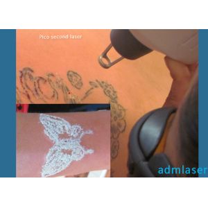 Pulse Width 8ns 1000W Q Switch ND YAG Laser Machine