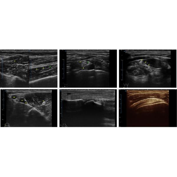 Sonoscape X5 Medical Ultrasound Instruments Machine with Excellent Image Quality