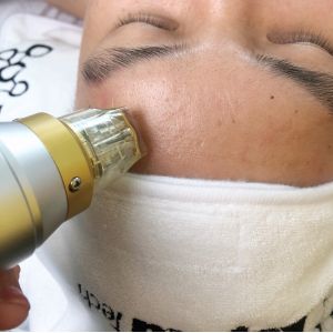 Touch Screen Microneedling Fractional RF Skin Rejuvenation 0.2MM Needle