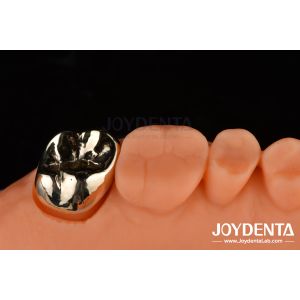 Dental Restoration Gold Metal Crowns for Oral Rehabilitation Treatment