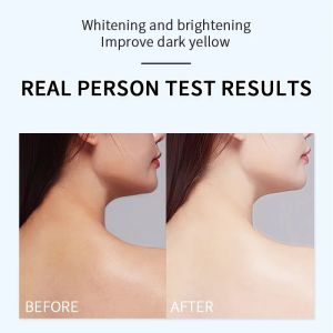 Bodycare Whitening Body Lotion Remove Black Spots And Dark Yellow Skin Care