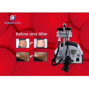 220V / 110V Vacuum Slimming Machine 1200W With 8.4"Color Touch LCD Screen