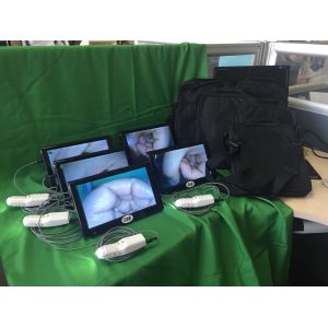 Portable Digital Electronic Colposcope
