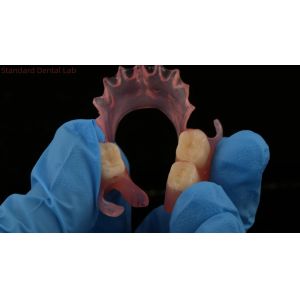 Dental TCS Valplast Flexible Partial Dentures Nesbit Valplast Finish China