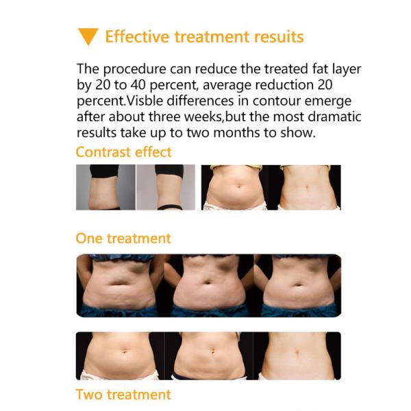 2 Cryo Handles Portable High Quality Cryo Machine for salon use body slimming