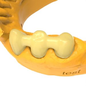 Low-Viscosity Permanent Crown Bridge Resin For Easy Handling