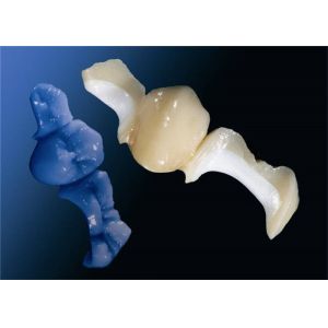 Customized OEM Polishing All-Ceramic Dental Crown Veneer Inlay Onlay