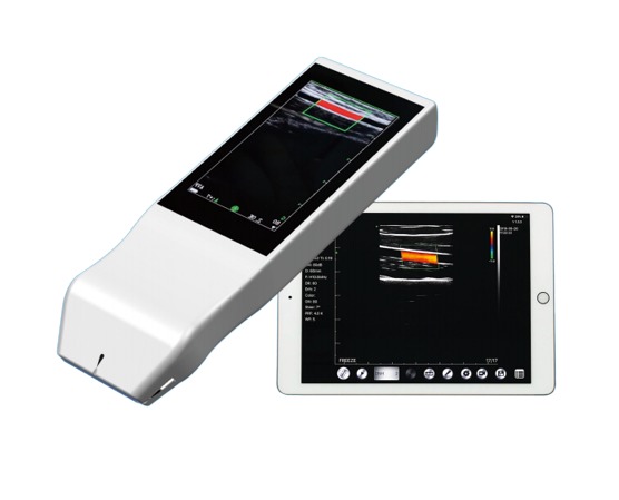 Wireless Linear Array Ultrasound Probe Handheld Wifi Ultrasound Scanner Price