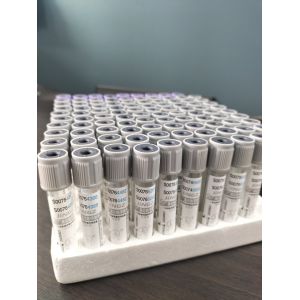 China Grey Cap Glucose Tube 2ml-10ml For Medical Blood Collection Vacuum Tube on sale