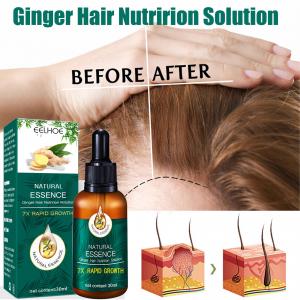 China Ginger Hair Growth Essence Germinal Hair Growth Serum Essence Oil Hair Loss Treatment Growth Hair for Men Women on sale