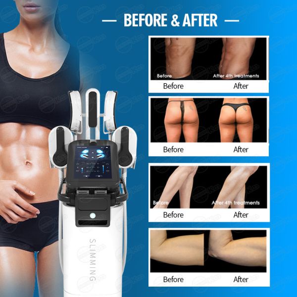 13 Tesla CE Em Sculpt Machine At Home Biphasic Wave