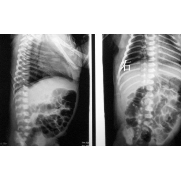 Buy 10 x 14inch Dry Medical X Ray Films For Fuji 3000 / 2000 / 1000 at wholesale prices