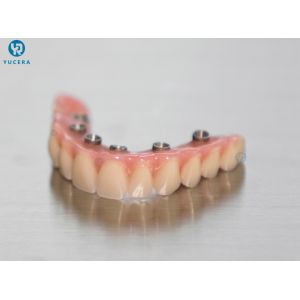 Yucera Durable Dental Monolayer PMMA for Reliable and High Quality Dental