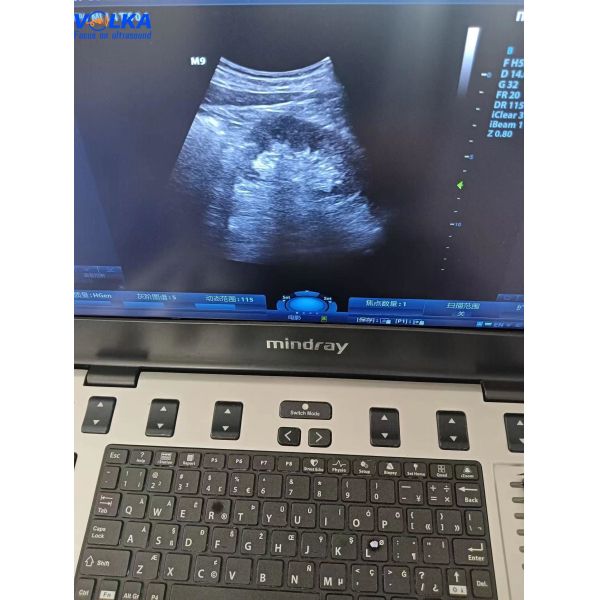 Buy Mindray Laptop Original Ultrasound System M9 Curved array at wholesale prices