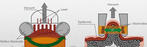 CE Certificate 1000W Power 1-50J Energy Ultrasonic Cavitation Slimming Machine