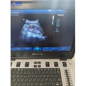Mindray Laptop Original Ultrasound System M9 Curved array