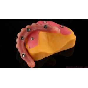 Acrylic Partial Implant Over Denture Titianium Bar Full Denture Teeth Set Up