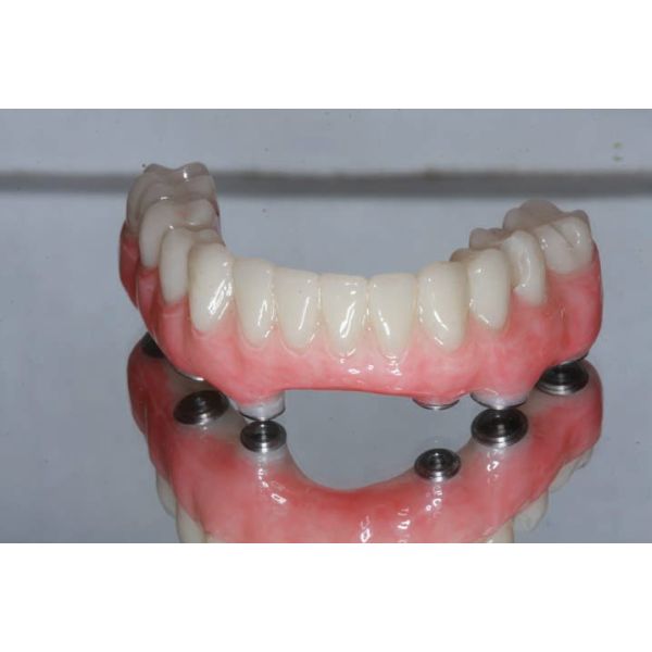 Yucera Monolayer PMMA Dental Block for Temporary Crowns and Bridges