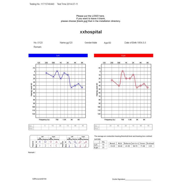Cheap Price Medical Diagnostic Screening Portable Clinical Audiometer With Software