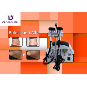 Vacuum Redundant Cellulites RF Cavitation Slimming Machine High Efficiency OEM