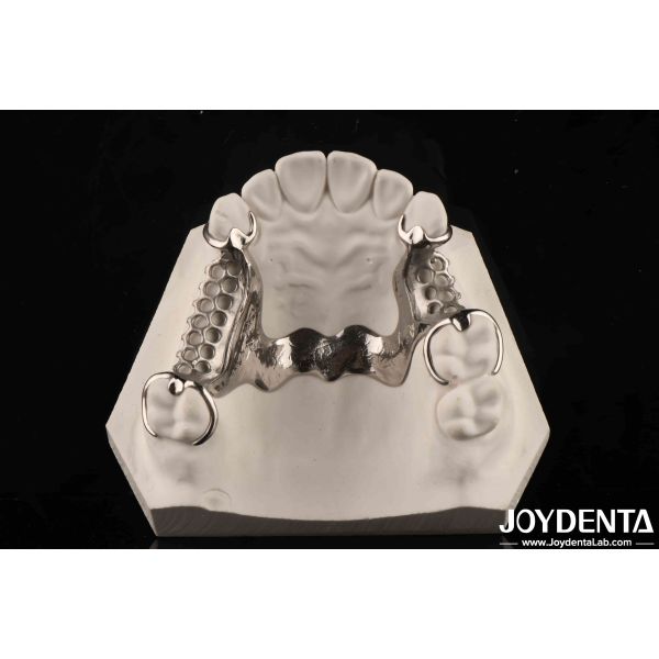 Clinical Practice Dental Alloying Metal Framework Good Fit In The Mouth