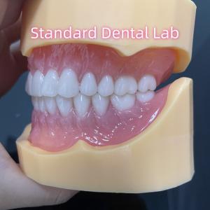 Durable Dental Prosthesis Full Arch Acrylic Teeth Partial Removable Dentures