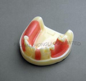Quality Implants Drilling Bone Grafting Gum Suturing Techniques Training for sale