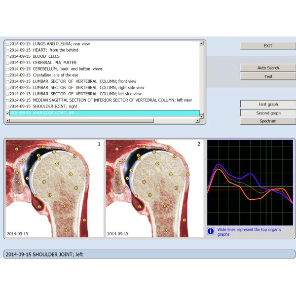 Professional Silver Portable 8D NLS IRIS Body Health Analyzer Machine Clinical Version