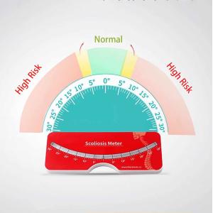 Custom Precise Scoliosis Scoliometer Measurement With Spine Contour
