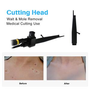 CO2 Fractional Laser Beauty Machine Medical Grade Vaginal Tightening Gynecology