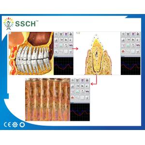 Russian Version Metatron NLS Hunter