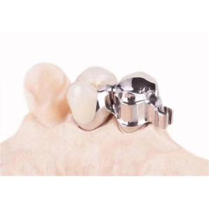 Quality Customized precision accessories for dental clinics for sale