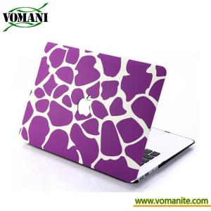 New PC Matte Hard Laptop Case Shell For MacBook Air 11"13"& Pro 13"15"