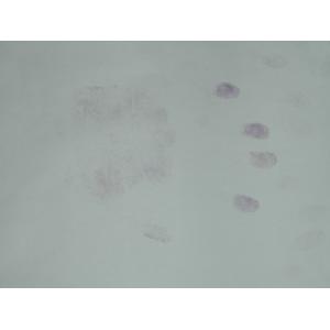 C005 Ninhydrin spray