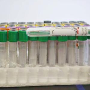 Automatic Labeling Machine for 13x75mm 13x100mm Blood Test Tubes