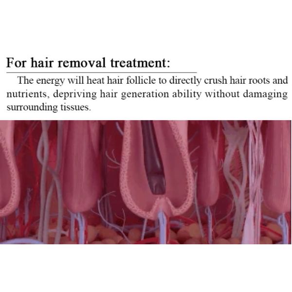 Painless Elight Laser Ipl Opt Hair Removal Machine Skin Rejuvenation 2in1